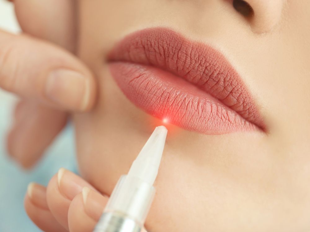 4 Tips for Maintaining Your Cosmetic Laser Equipment